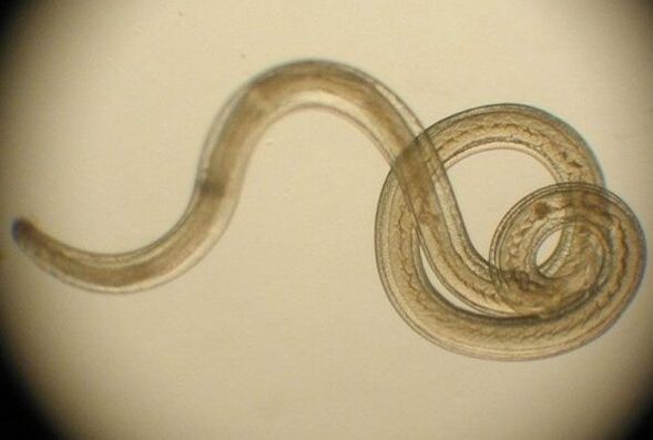 červ parazit z lidského těla