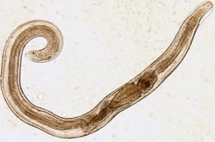 pinworms v lidském těle
